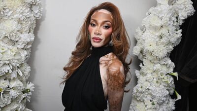Winnie Harlow